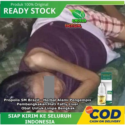Propolis SM Brazil - Herbal Alami Pengempis Pembengkakan Hati Fatty Liver, Obat Untuk Limpa Bengkak 