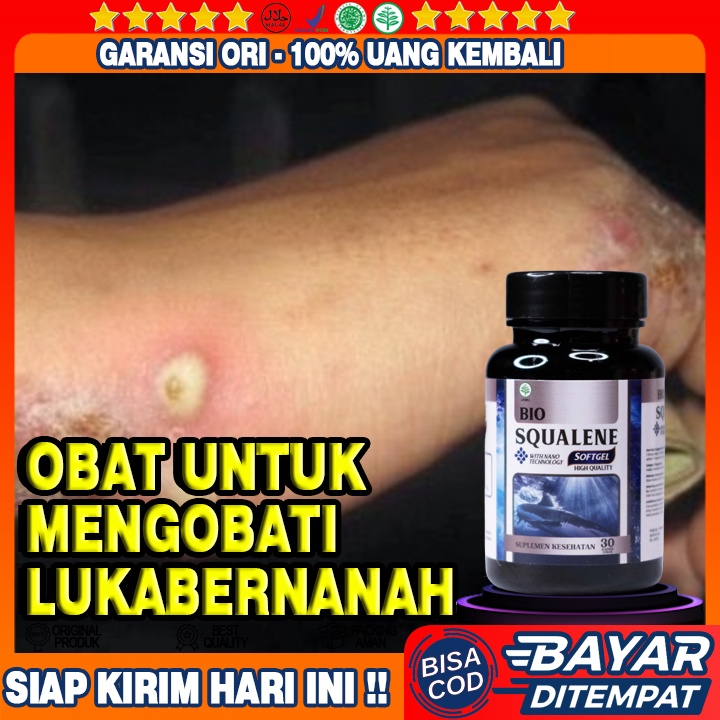 Obat Luka Bernanah - Obat Koreng Bernanah - Obat Borok Bernanah - Obat Herbal Pengering Luka Bernana