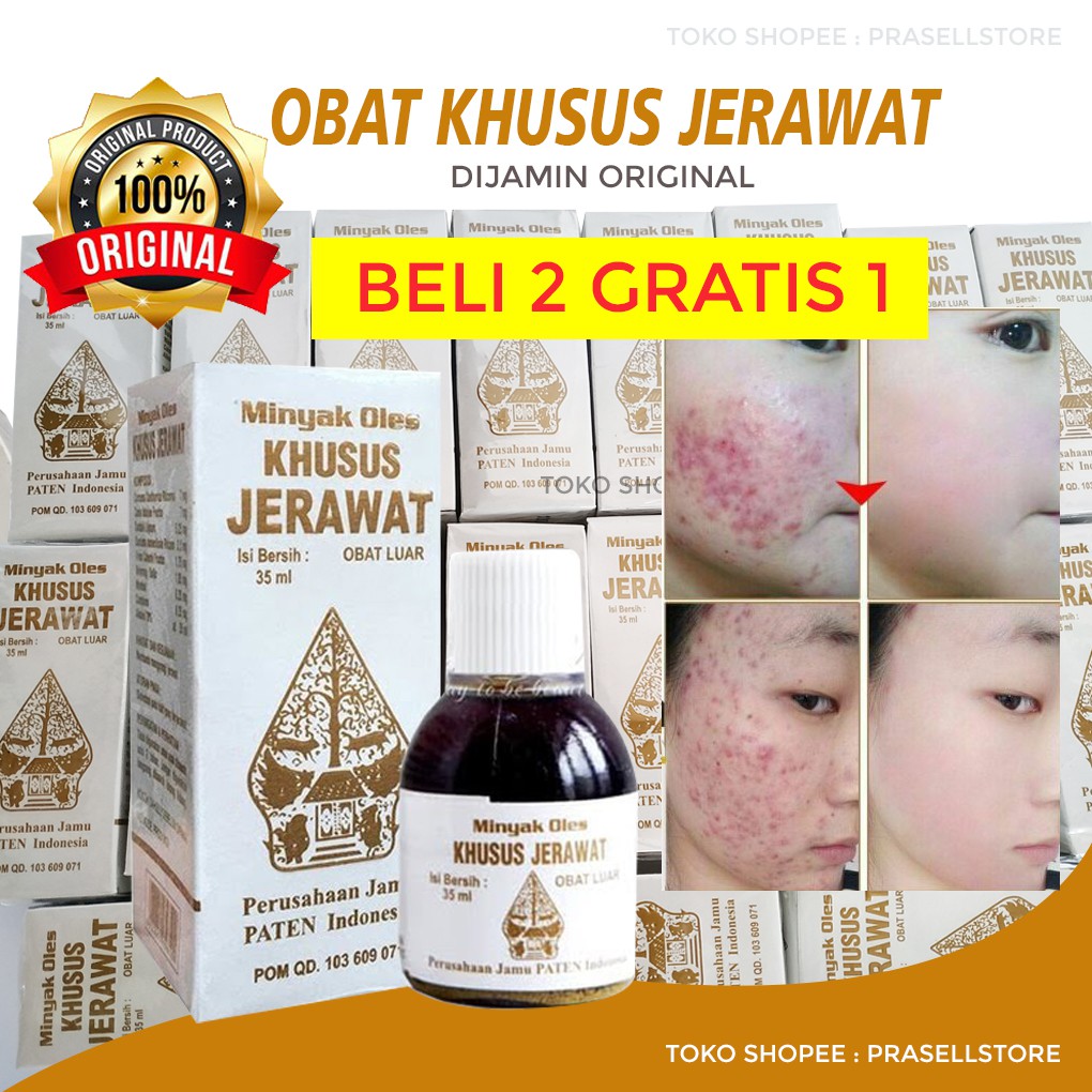 ORIGINAL! Minyak Oles Khusus Jerawat Cap Wayang terbaik / Obat Jerawat Ampuh / Penghilang Jerawat