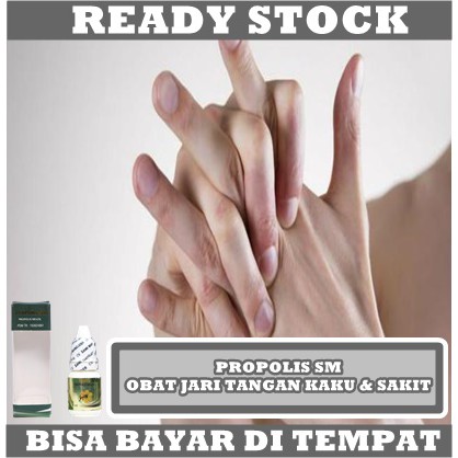 Obat Jari Tangan Kaku Dan Sakit, Obat Triger Finger, Obat Jari Susah Ditekuk, Obat Jari Susah Digerakan, Obat Sakit Telapak Tangan, Obat Telapak Tangan Dan Kaki Kebas Kesemutan, Obat Jari Pelatuk Dengan ProPolis SM