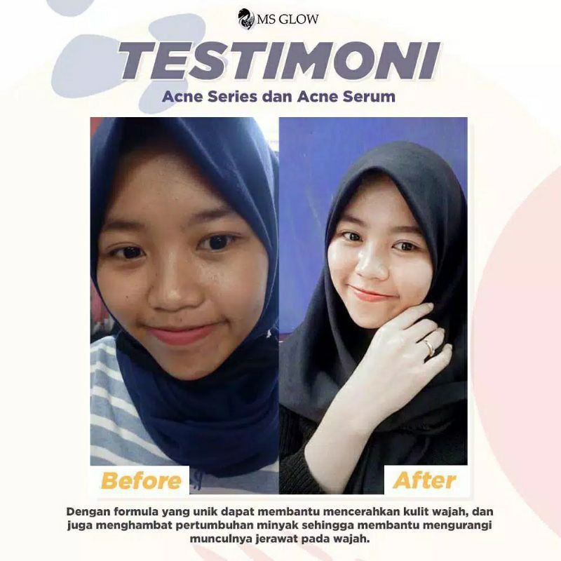 MS GLOW Paket Free Bonus Pouch/Dompet Kosmetik/Ecer Whitening Night Cream/Luminous/Malam Ultimate/Krim Siang/Facial Wash Msglow/Toner Acne/Glowing/Sabun Men/Day/Man Basic/Serum Gold/Peeling/JJ Glow/DTE/Underarm/Red Jelly/Radiance Gel/Scrub Original Asli