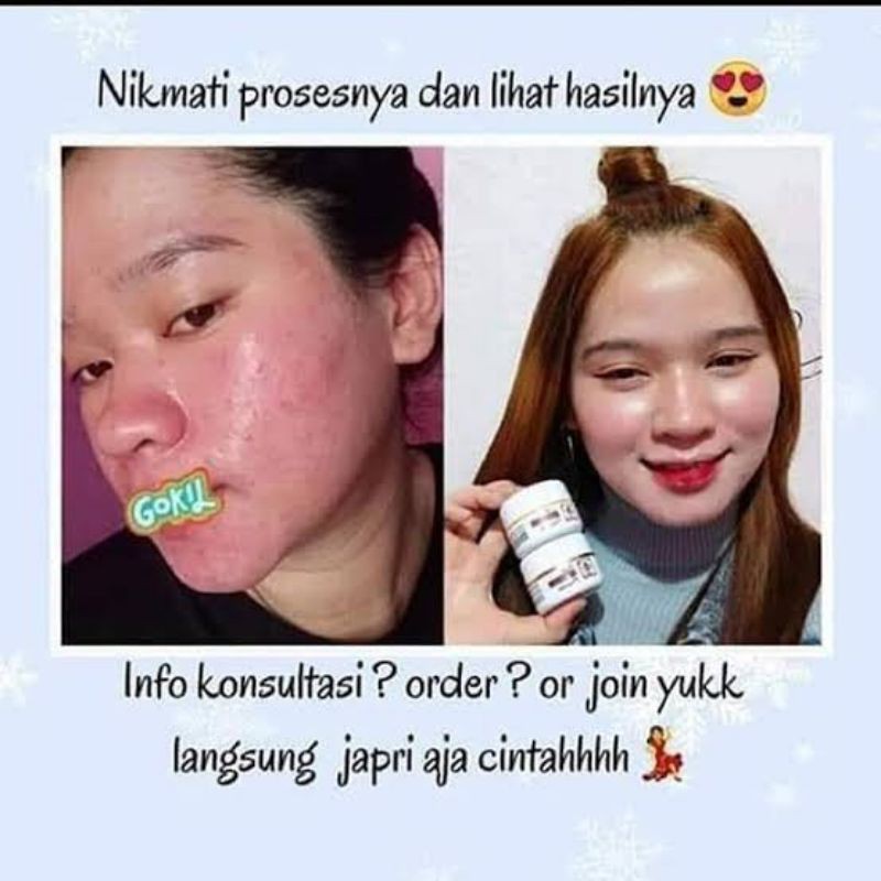 RK Glow Skincare Acne Series