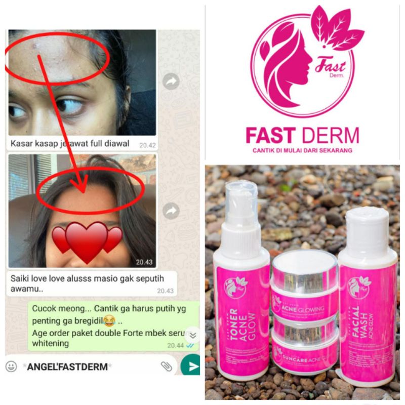 FAST DERM acne glow