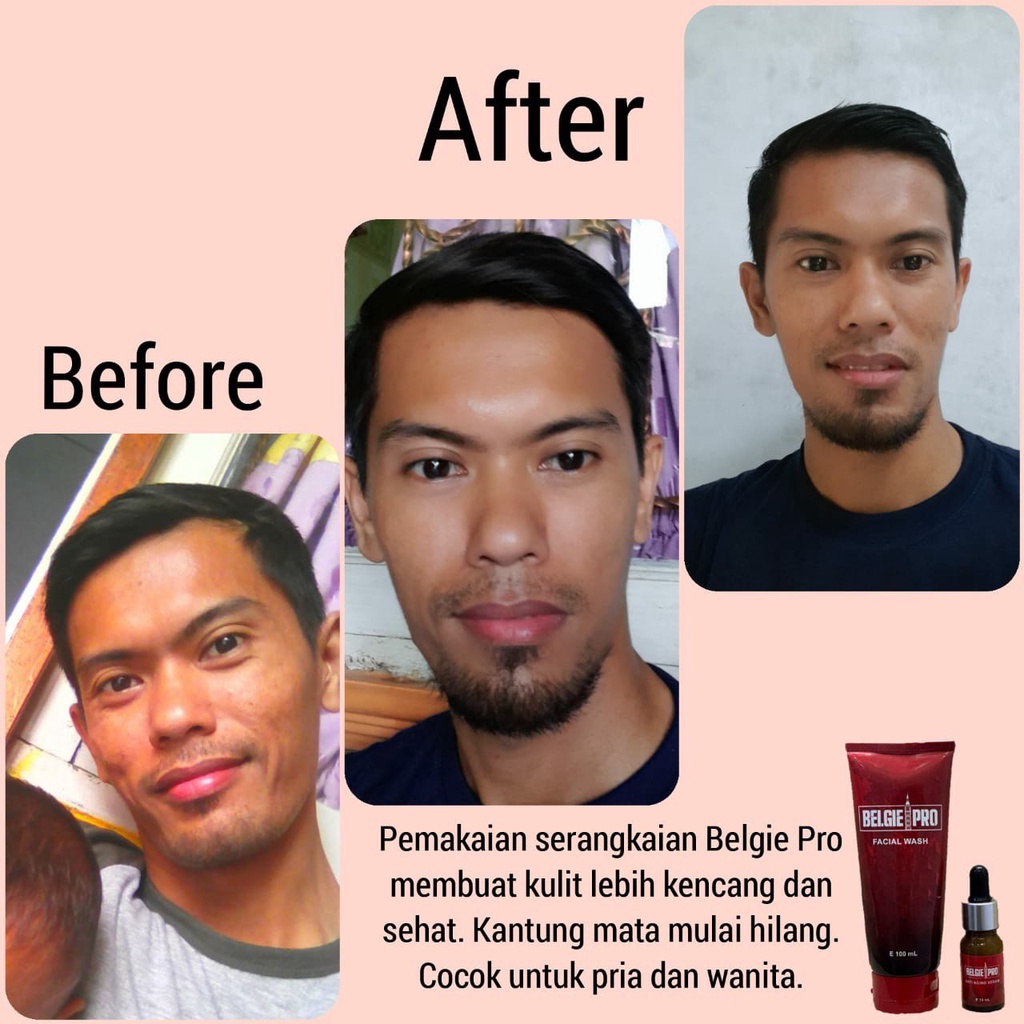 BELGIE PRO ANTI AGING PAKET SERIES WITH PROPOLIS BEST SELLER TERLARIS 100% ORIGINAL IPPHO SANTOSA