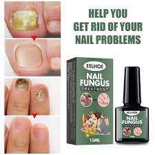 NAIL FUNGUS TREATMENT 15ML OBAT JAMUR KUKU BY EELHOE