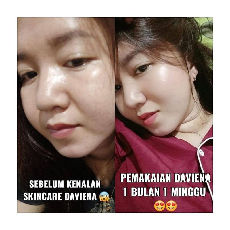 (Pusat Jawa)Daviena Skincare|GOLD SERIES|PEMUTIH WAJAH BPOM DAVIENA SKINCARE|DAVINA SKINCARE