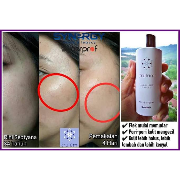 Krim Pemutih Wajah Paling Ampuh BPOM Hilangkan Flek Hitam & Keriput