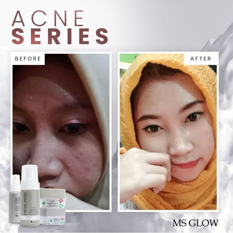 (Original 100%) Ms Glow Paket Wajah Luminous/Whitening/Acne/Ultimate / Paket Wajah Ms Glow