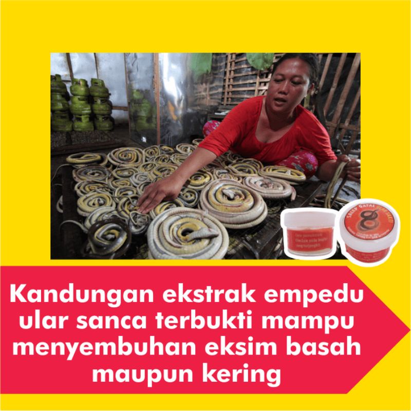 Salep Obat Gatal Eksim Kering Basah Menahun Paling Ampuh Kurap Panu Selangkangan Jamur Gatel Kulit-6