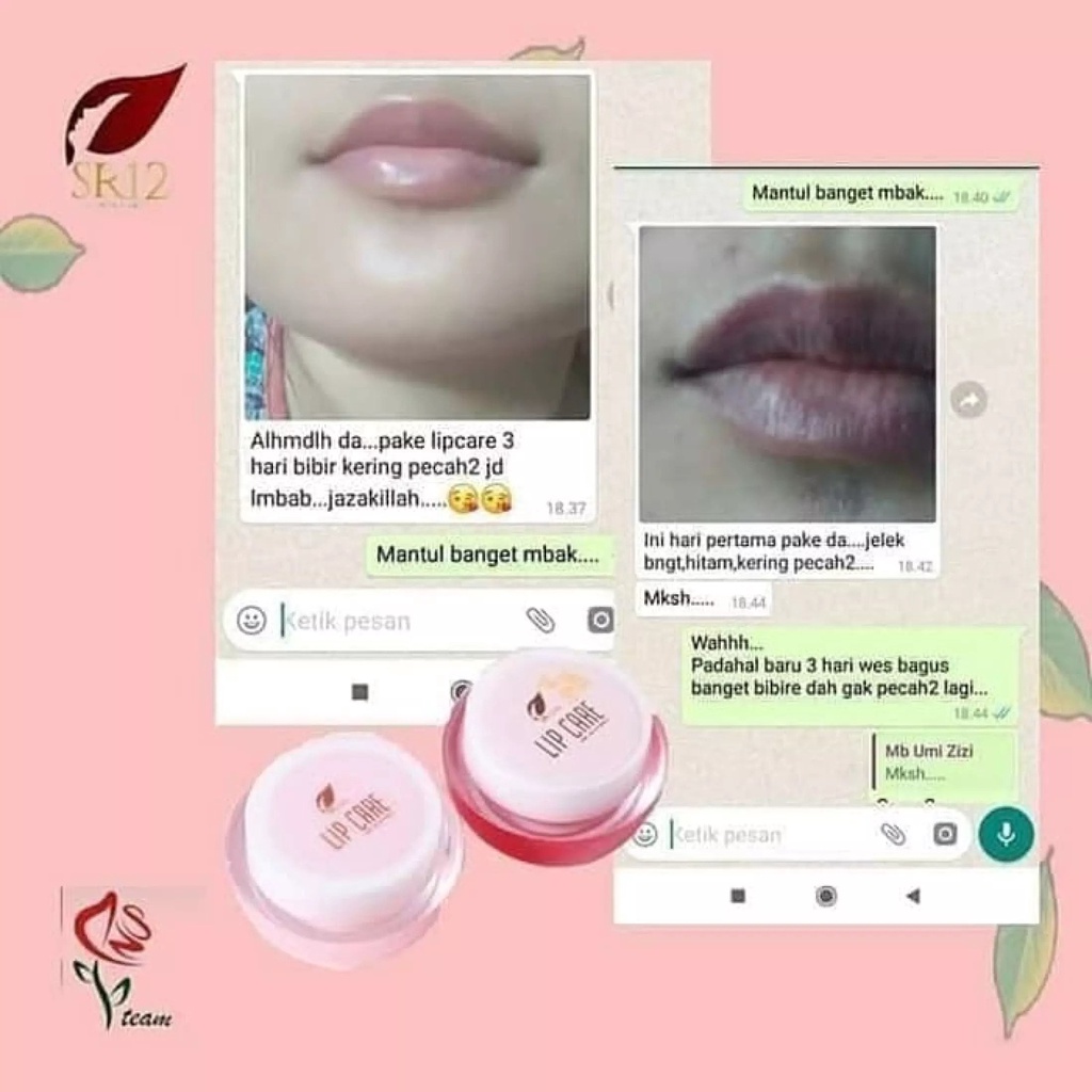 Lip Care SR12 | Lip Care Natural SR12 &amp; Lip Care Cherry SR12 | Pelembab Bibir SR12 Skincare