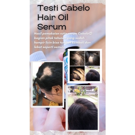 Serum rambut - Hair serum - Anti rontok || Serum rambut Cabelo penumbuh rambut ampuh-5