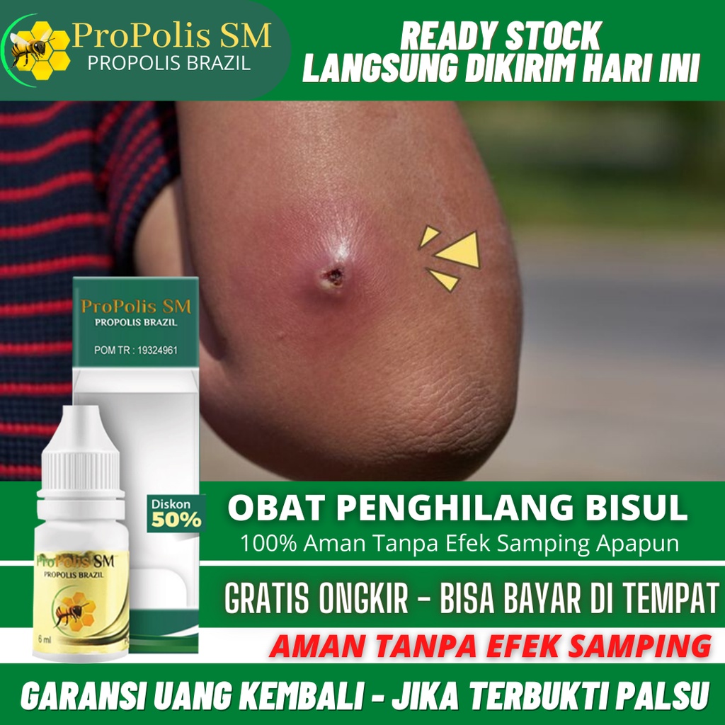 Obat Bisul, Obat Penghilang Bisul, Benjolan Bernanah, Bisul Di Pantat / Jidat / Wajah, Bisul Parah, 