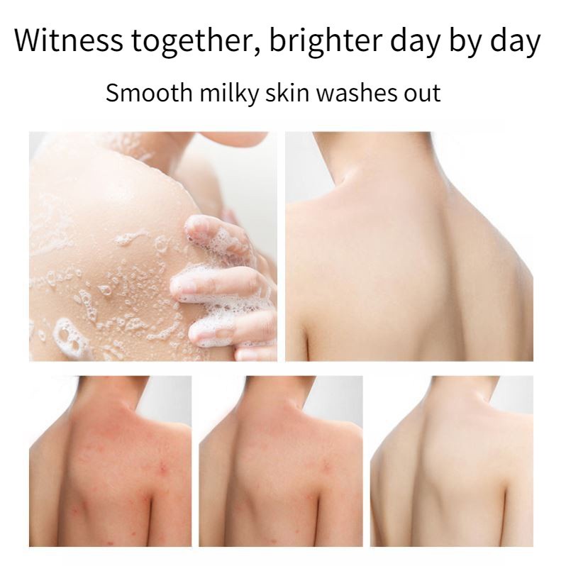 Body Wash Whitening Anti Acne Sabun Mandi Jerawat Pemutih Tubuh Body Lotion Penghapusan Tungau Antibakteri Kulit