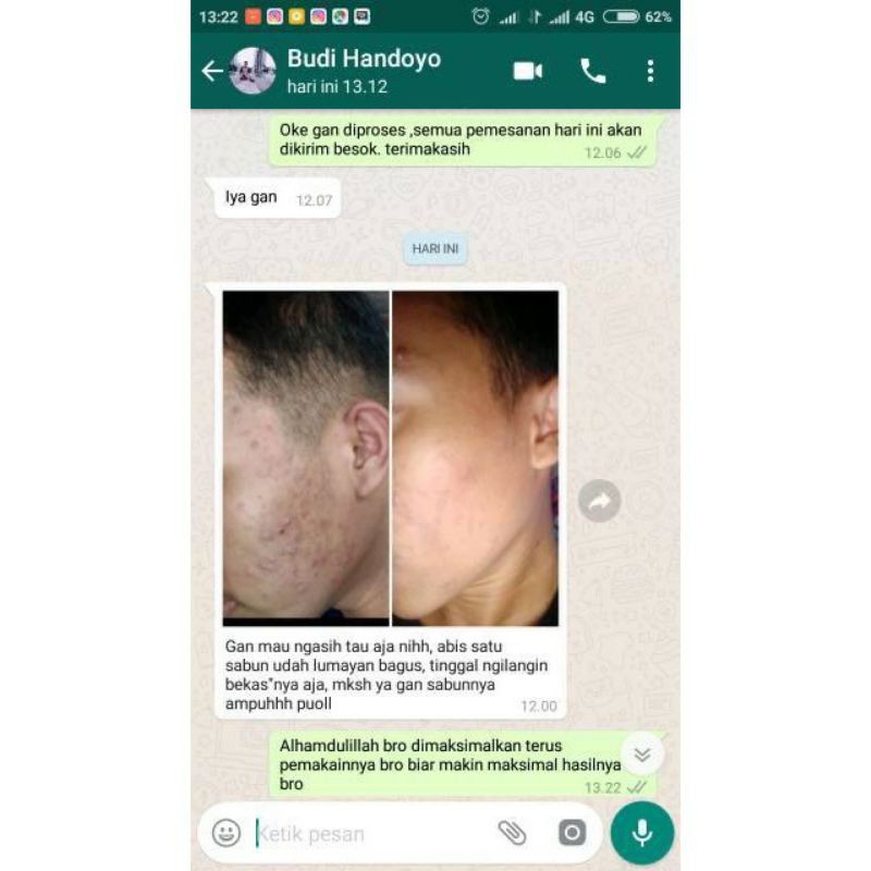 CLORIS MEN SOAP CLORIS SABUN BATANG CUCI MUKA CLORIS SABUN WAJAH CLORIS MEN