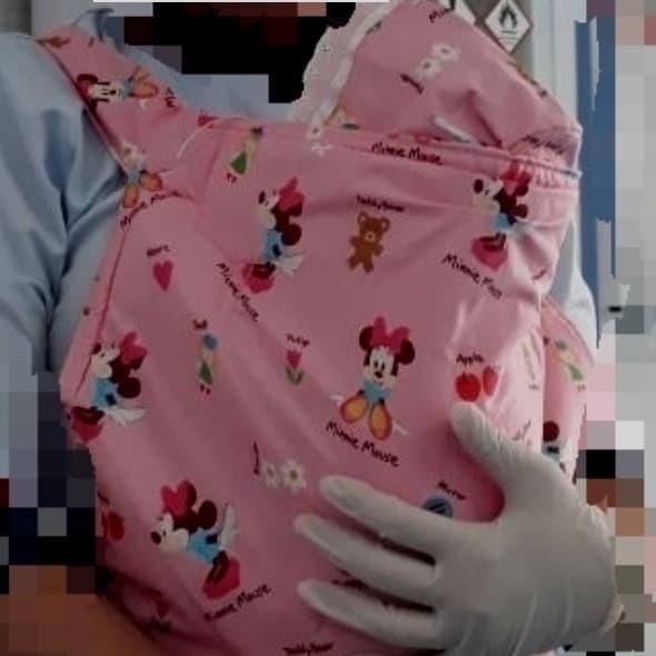 Gendongan Kangguru (Metode Kangguru Bayi Prematur)