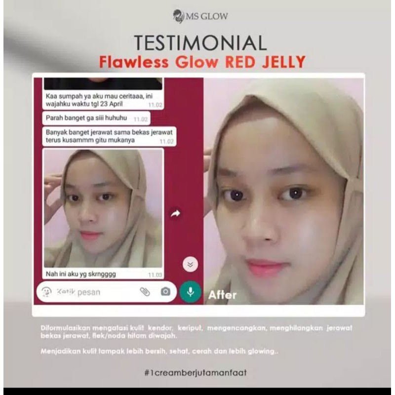 

MSGLOWredjellyori