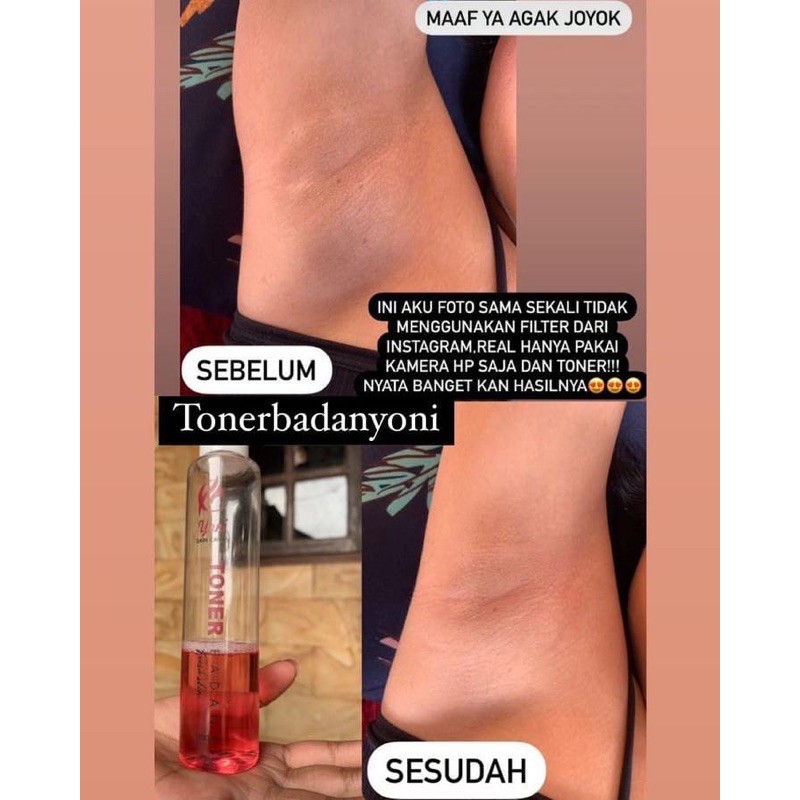 toner badan yoni penghilang daki