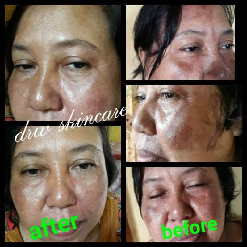 NEW ORIGINAL !!! COD Cream BEKAS LUKA/DermaBright By DRW SKINCARE