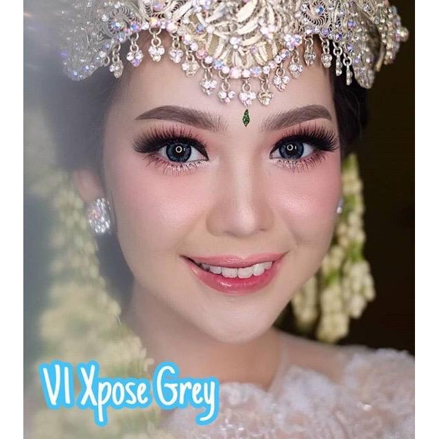 SOFTLENS OMEGA V1 XPOSE 14.2mm - Normal