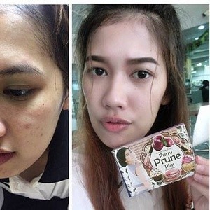 ORIGINAL PURRY PRUNE PLUS WHITENING BY LITTLE BABY