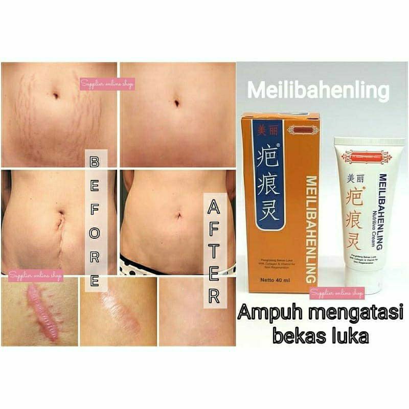 

Meibhaheling