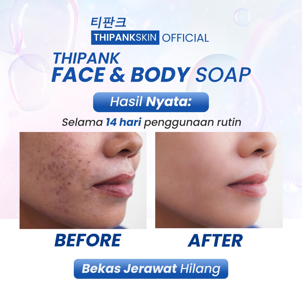 Thipank skin soap facial wash sabun pemutih wajah sabun pencerah wajah sabun jerawat dan bekas jerawat sabun pemutih wajah dan badan