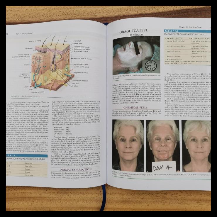 

TERBARUU!! Buku Kedokteran Grabb and Smith's Plastic Surgery 7e SALE