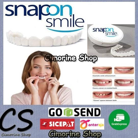 Snap On Smile Authentic / Gigi Palsu Snapon Smile 1 Set Veneer Gigi