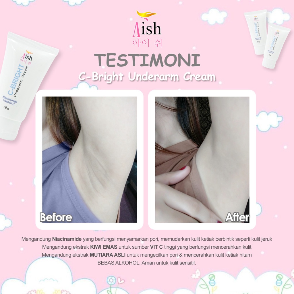 AISH KRIM KETIAK / AISH KRIM SELAKANGAN / BISA COD! AISH UNDERARM CREAM / AISH C BRIGHT AISH C BRIGHT UNDERARM CREAM / AISH UNDERARM KOREA / AISH NECK SERUM / C BRIGHT KETIAK ORIGINAL ORI 100%