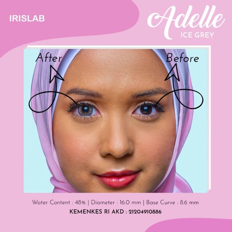 Softlens ADELLE 16 MM Normal Minus By Irislab / Soflen Adelle / Adelle By Iris Lab
