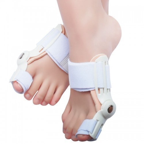 Hallux Valgus bunion therapy terapi 1 pasang tanpa bedah operasi kaki