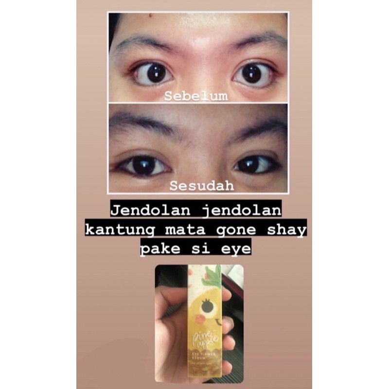 PINEAPPLE EYE FIRMER SERUM HOLLASIAN X HELLODERMA EYE SERUM PENGHILANG MATA PANDA DAN KANTUNG MATA