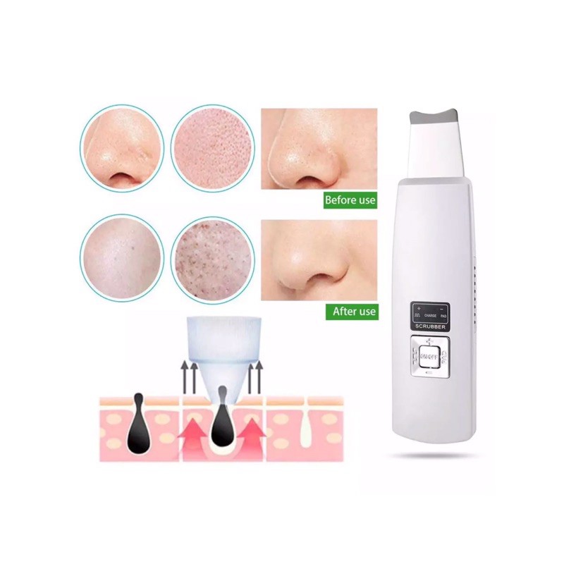 KD-8020 portable alat kecantikan skin scrubber