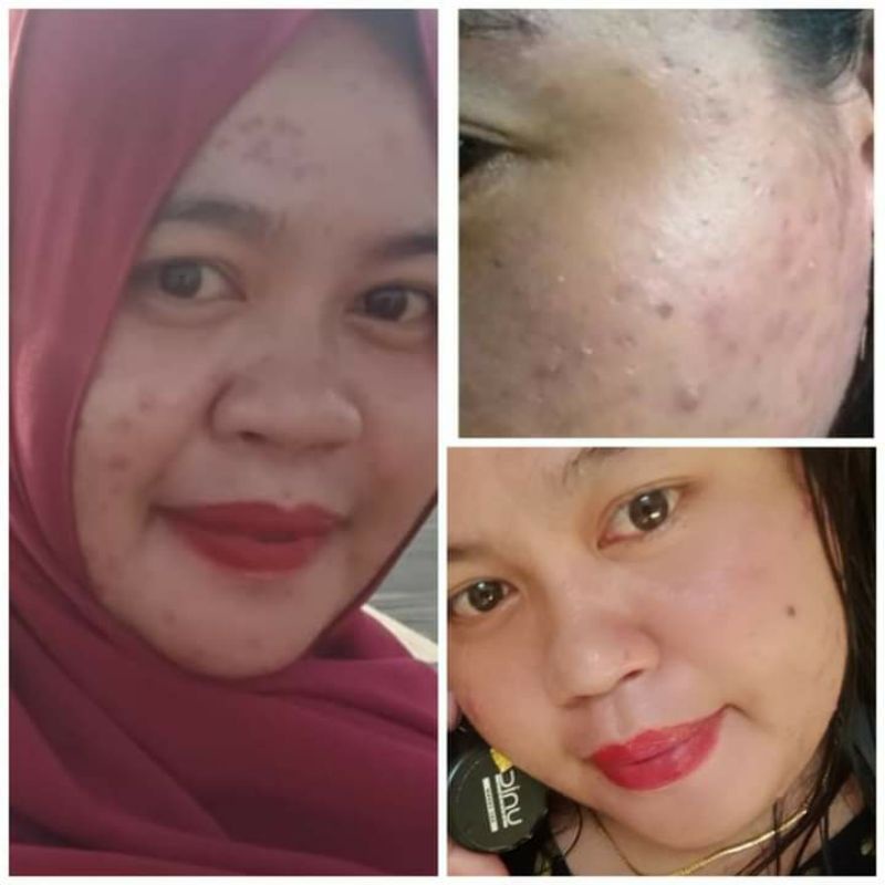 UNIC Skincare Harga Ecer