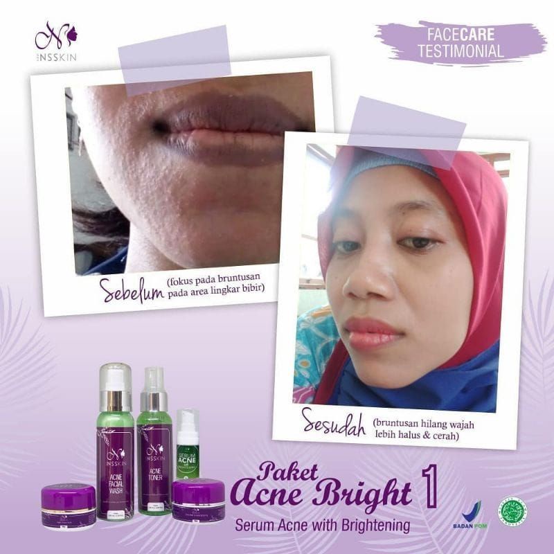 NEW NSSKIN PAKET REGULER ACNE