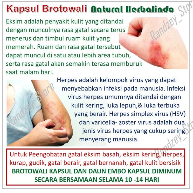 Brotowali obat gatal kulit eksim alergi biduran herbal daun jamu suplemen kesehatan isi 50 kapsul-4