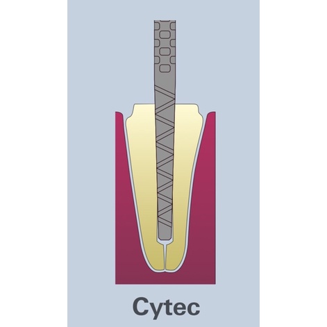 Hahnenkratt Cytec Fibre Post