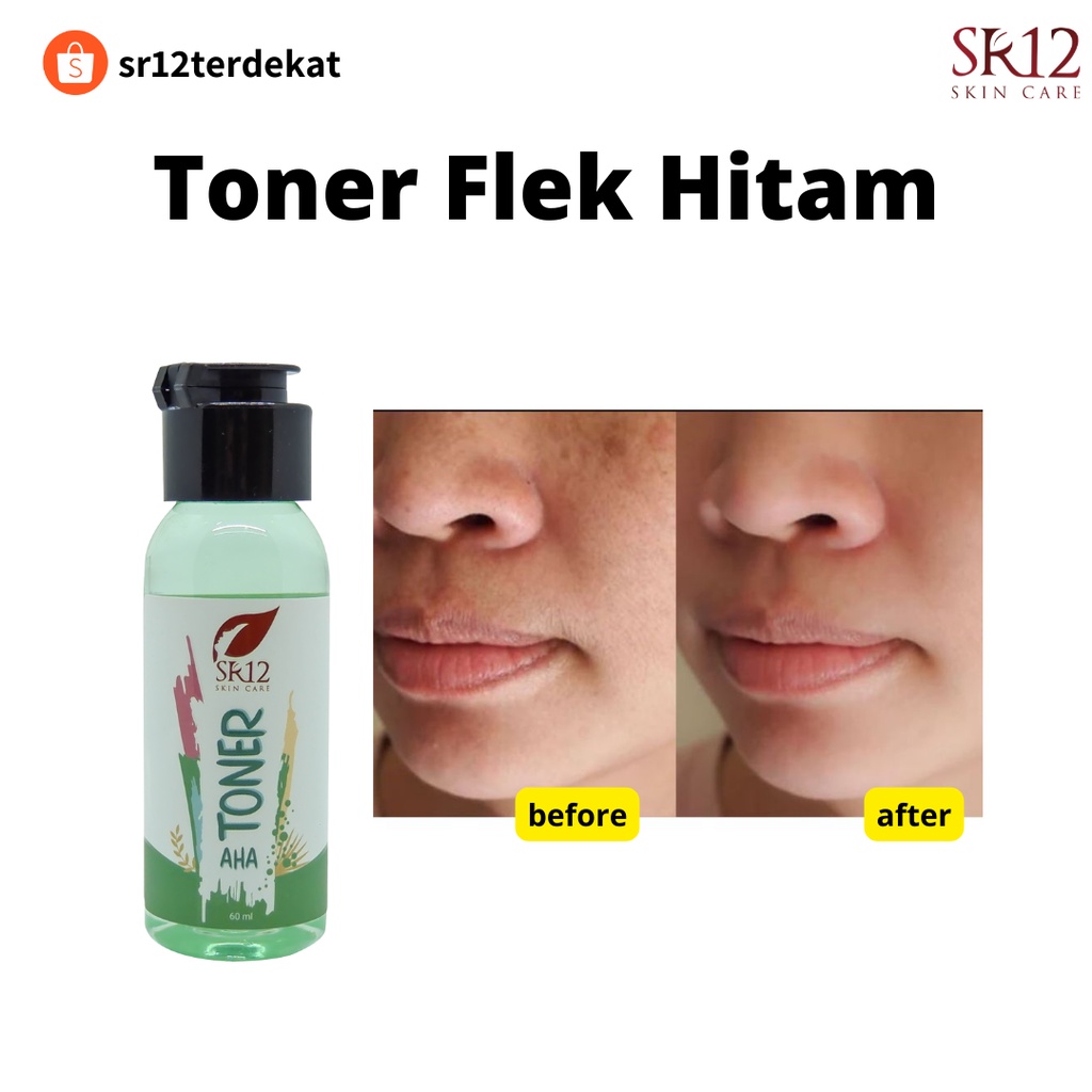 Toner Flek Hitam Sr12