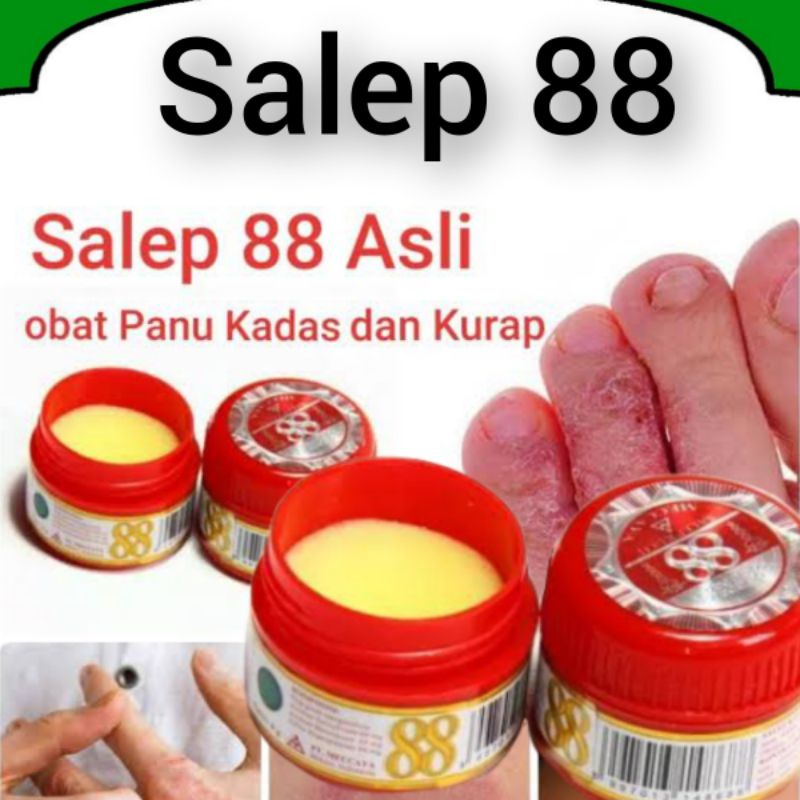 Salep 88 6gr Obat Panu Kurap Kudis Kutu Air