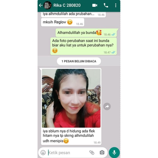 Cream REGLOW Untuk menghilangkan Flek Jerawat Kerutan-3