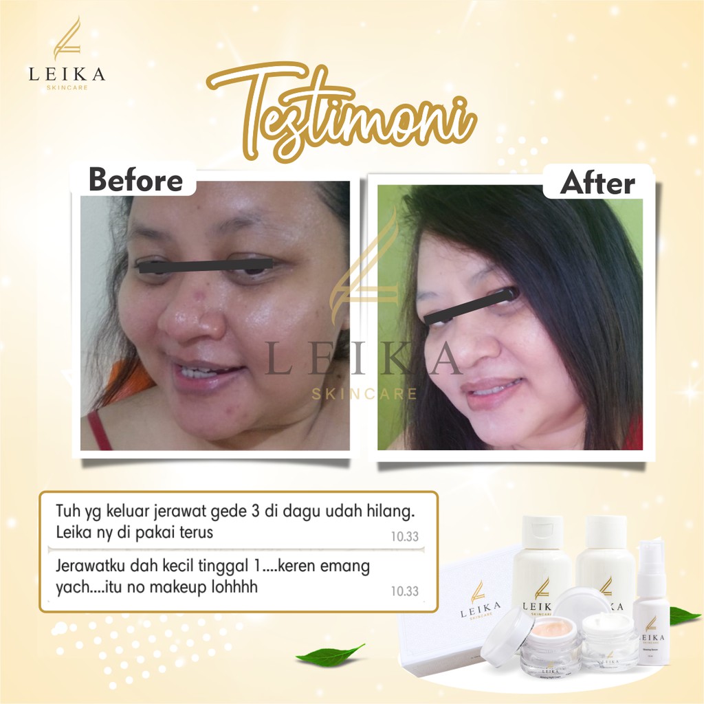 Leika Skincare Paket 5 in 1-5