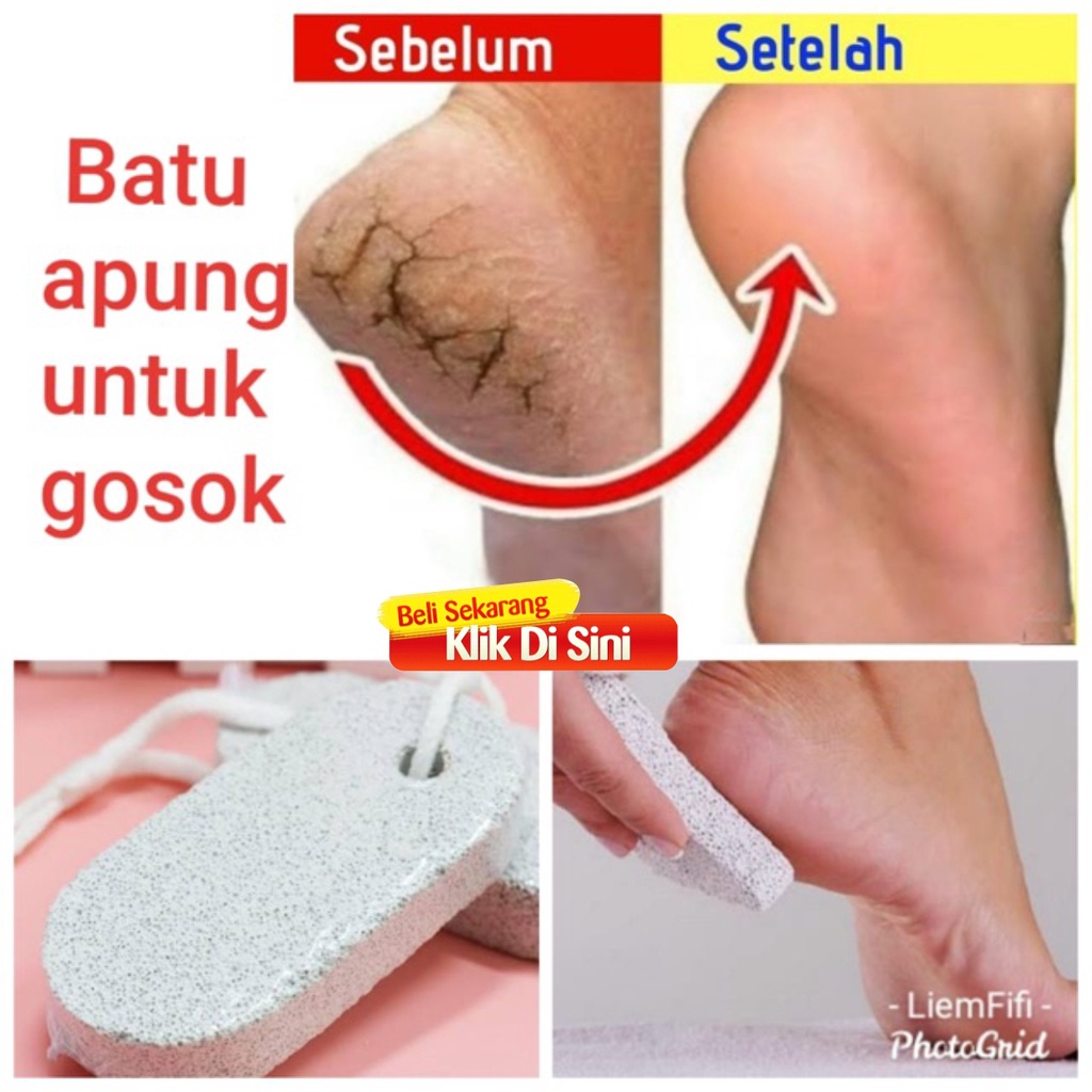 SHINE STAR - Pedicure Batu Apung Gosok Sikat Kaki Pembersih Kulit Mati Kecantikan