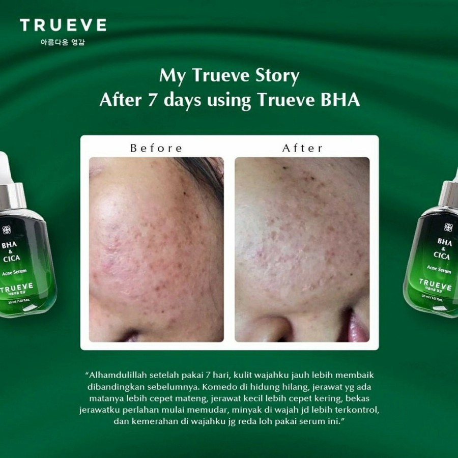 TRUEVE BHA &amp; CICA Acne Serum