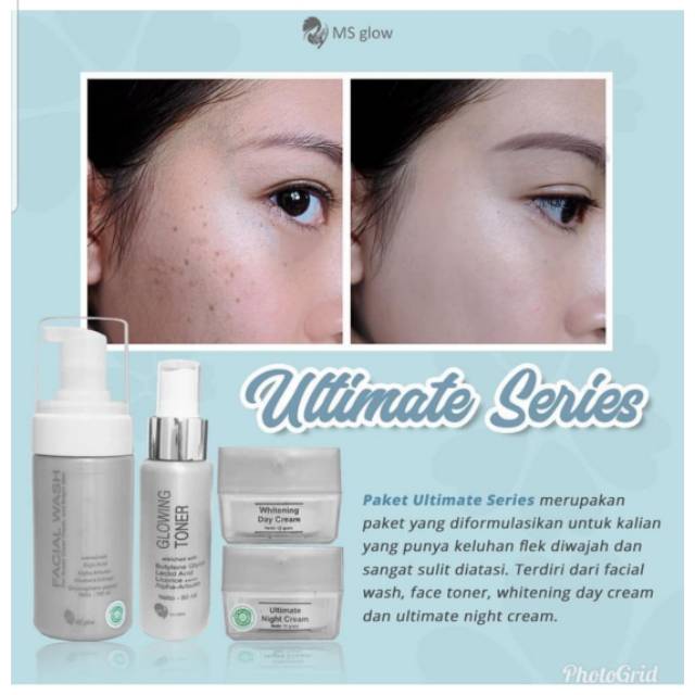 MS Glow Ultimate Series/Paket Wajah Flek Ms Glow