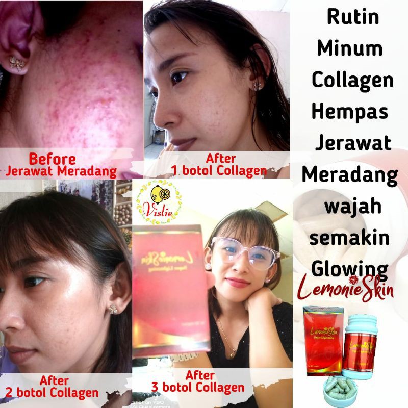 TERLARIS COLLAGEN DLEMONIE C-LEMONIESKIN SUPER LIGHTENING BPOM HERBAL