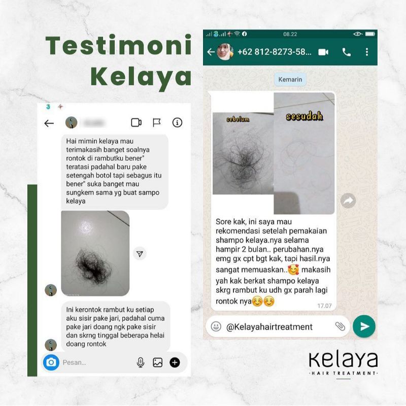 KELAYA HAIR TREATMENT SHAMPOO RAMBUT ANTI RONTOK 250ML / Promo 2 Botol Kelaya Hair Treatment Shampo KEMIRI ANTI KETOMBE RONTOK PENUMBUH RAMBUT AMPUH BPOM