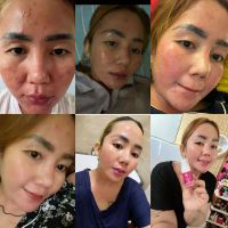 KRIM PEMUTIH WAJAH GLOWING PENGHILANG FLEK DALAM 5 HARI ECER KRIM ZAYORA SKINCARE UNTUK KULIT SUSAH PUTIH FLEK HITAM JERAWAT BRUNTUSAN DAN NORMAL