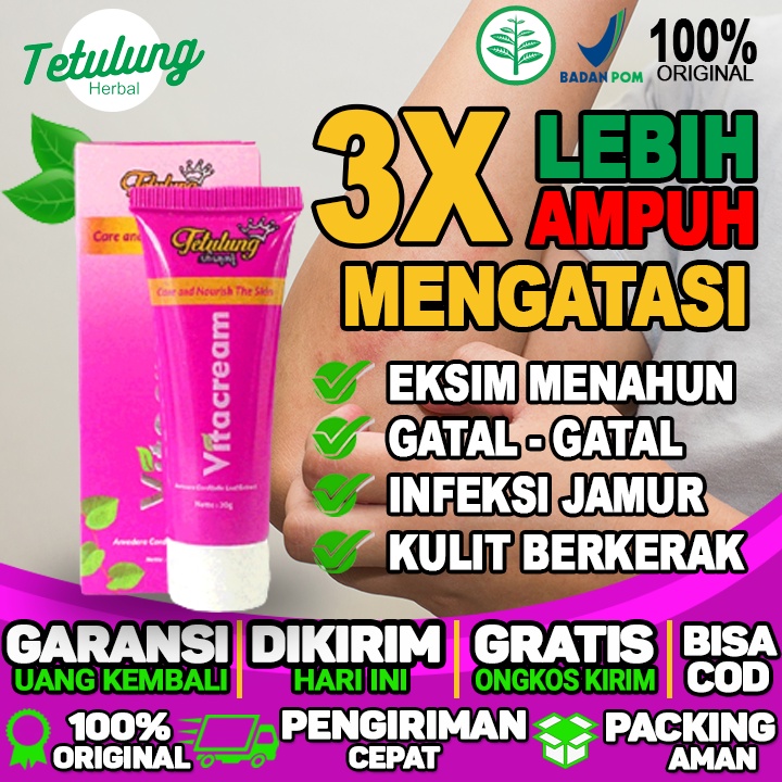 Salep Eksim Kering Tradisional Salep Eksim Basah Tradisional Yang Ampuh Salep Alami Eksim Basah Sale