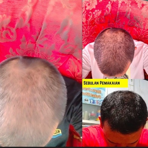 KELAYA HAIR TREATMENT bisa COD dijamin ORI Shampoo Shampo Botak Rontok Penumbuh Rambut kelayang kalaya-2