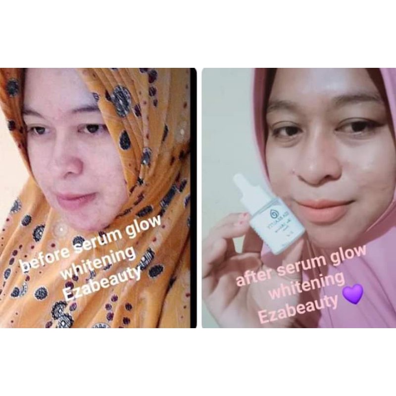 SALE MURAH SERUM GLOW WHITENING EZA BEAUTY 20ml